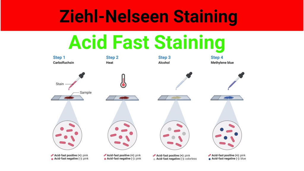 Acid Fast Stain Positive - Acid-fast Staining Procedure Flow Chart