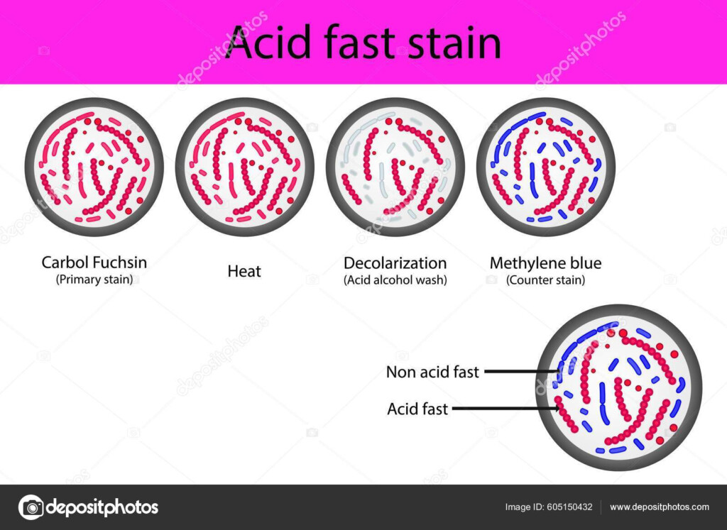 Acid Fast Staining Microbiology Lab Technique Steps Diagram Using  - Chart Off Acid Fast Staining Steps