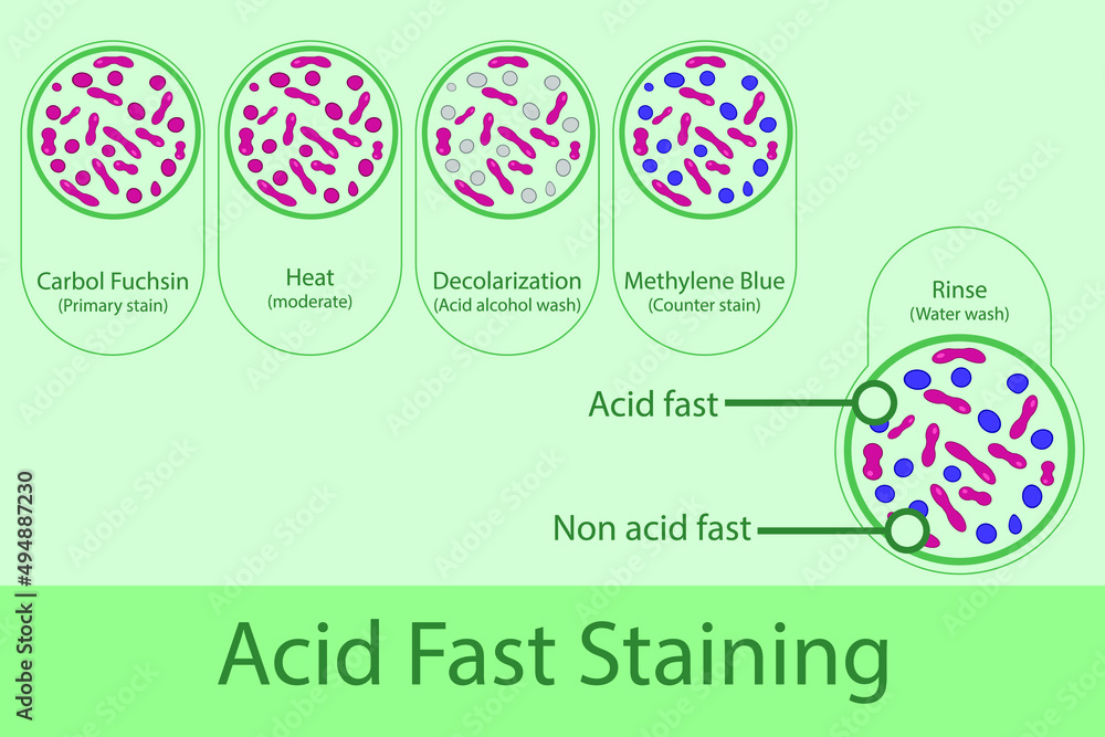 Acid Fast Staining Technique Steps Diagram Using Carbol Fuchsine And  - Acid Fast Staining Flow Chart