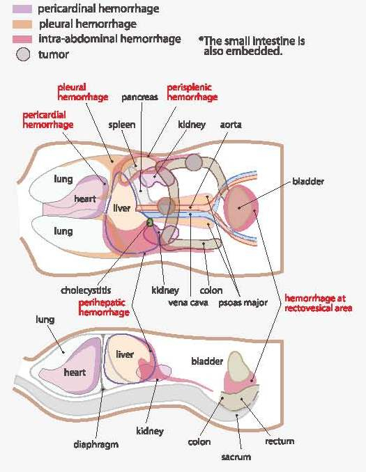  FAST ER FAN Focused Assessment Sonography For Trauma Acute Abdomen  - Fast Trauma Flow Chart