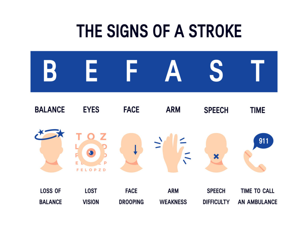 Fast Stroke - Stroke Act Fast Chart