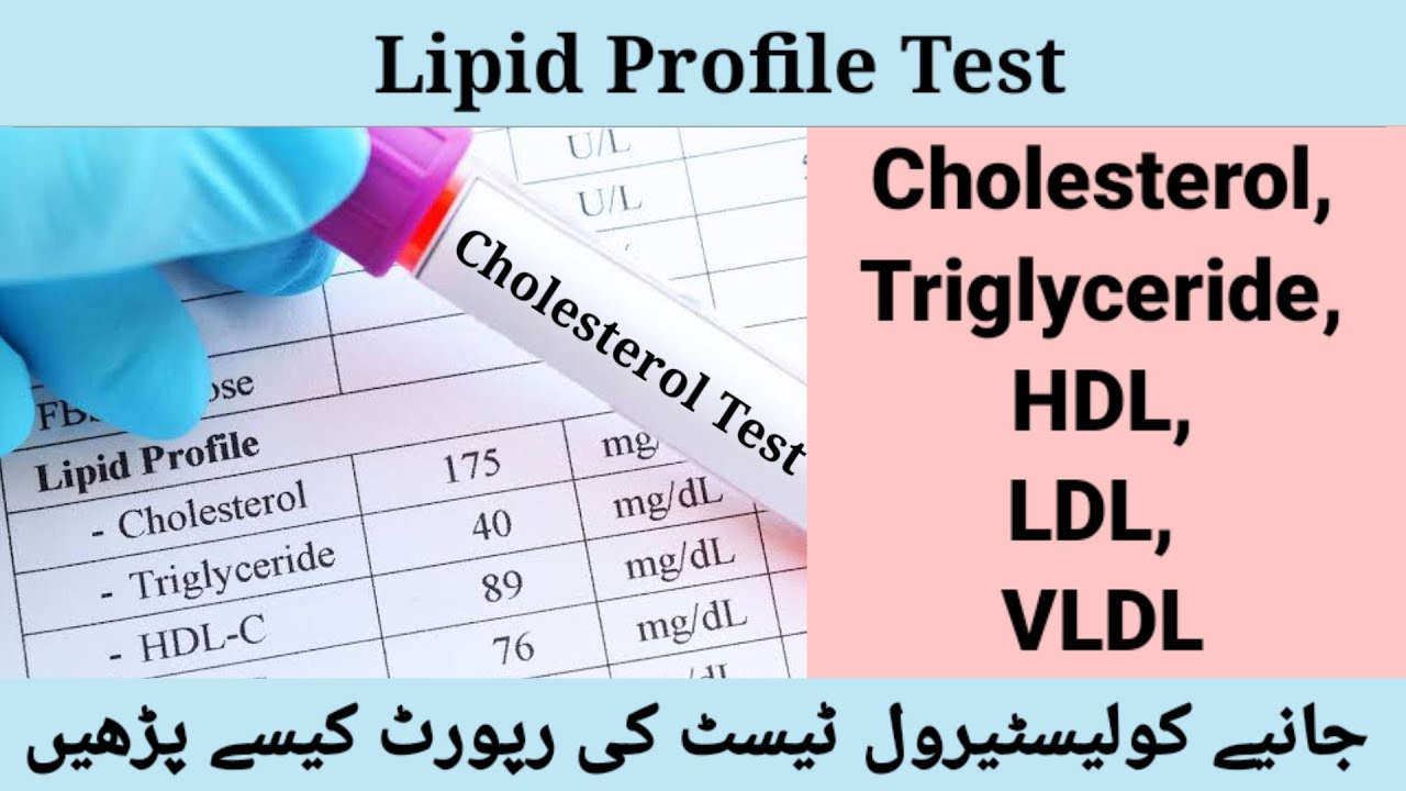 Fasting Lipid Profile Test Blood Cholesterol Test Normal Level  - Fasting Cholesterol Levels Chart