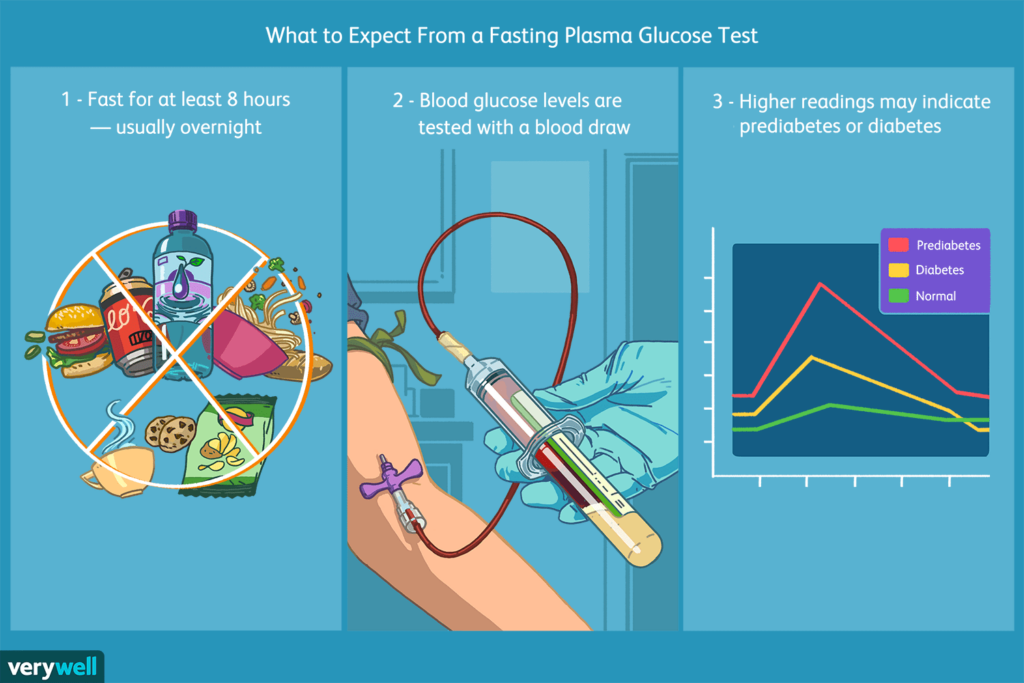 Fasting Plasma Glucose Test Uses Procedure Results - Fasting Plasma Glucose Chart