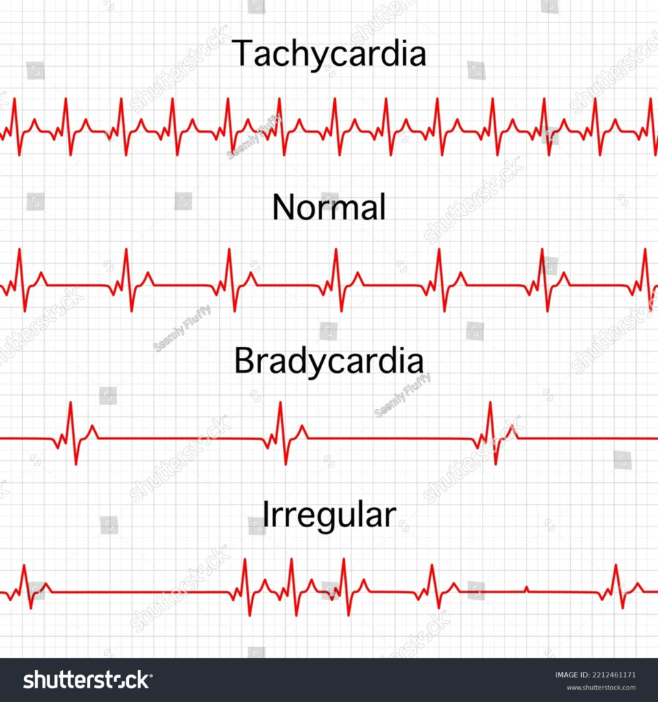 Heart Rate Graphics Vector Illustration Electrocardiogram Stock Vector  - Fast Heart Beat Chart