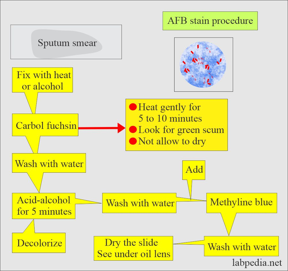 Mycobacterium Tuberculosis Part 4 AFB Stain Acid Fast Bacilli  - Chart Of Acid Fast Staining Steps