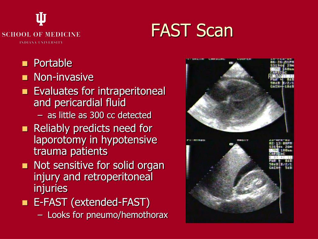 PPT Approach To Trauma Patients PowerPoint Presentation Free  - Fast Trauma Flow Chart