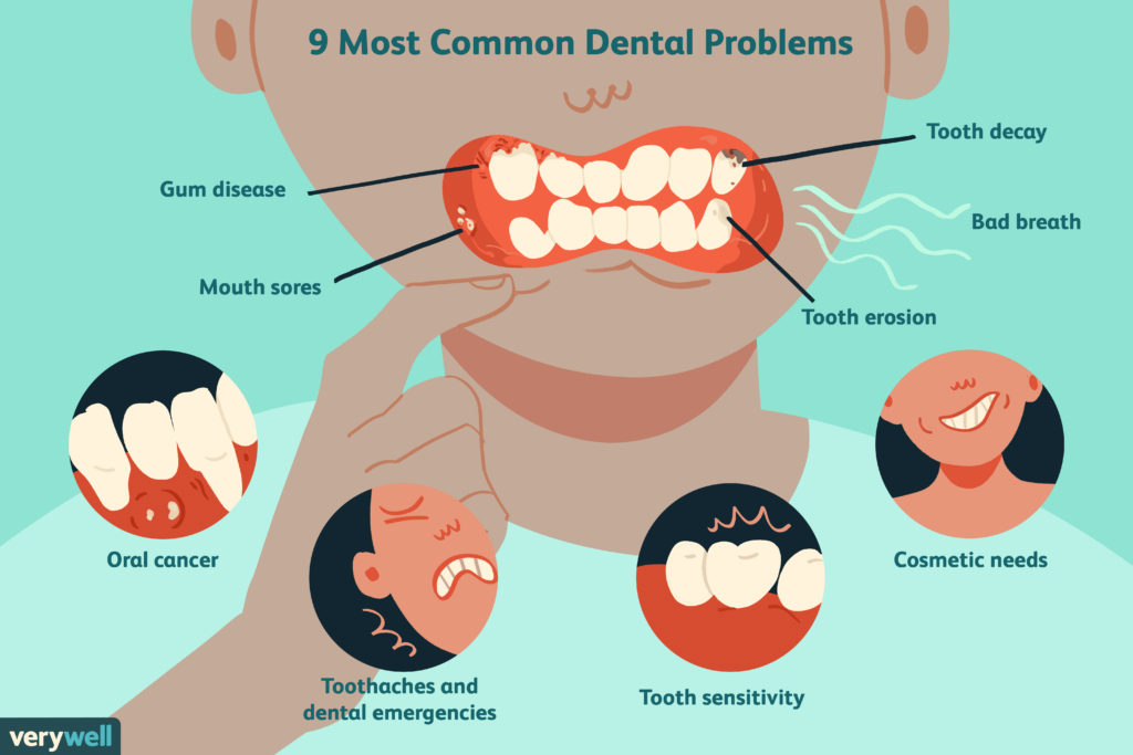 The 9 Most Common Dental Problems - Chart Of Teeth Issues From Fast Food