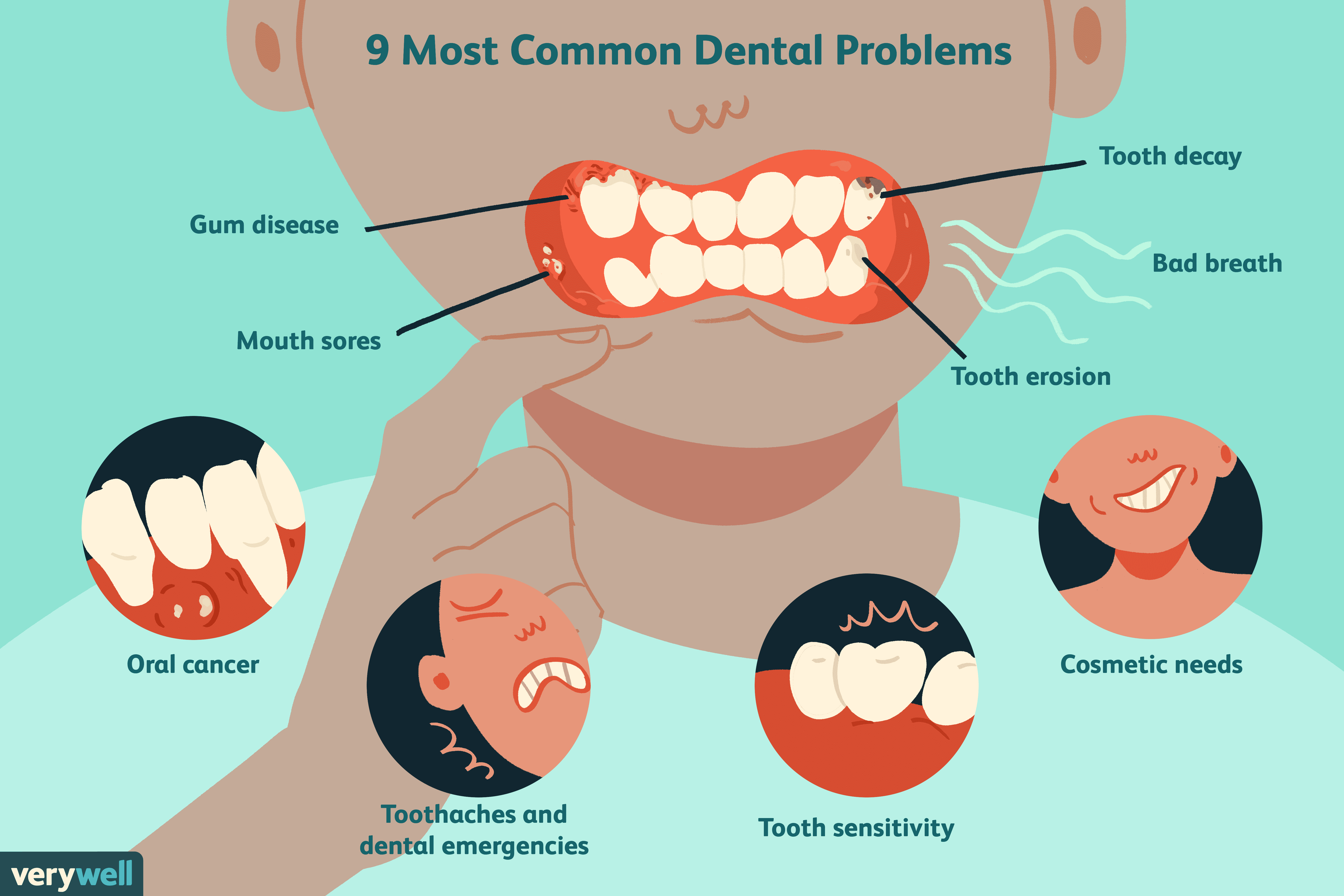 The 9 Most Common Dental Problems - Chart Of Teeth Issues From Fast Food