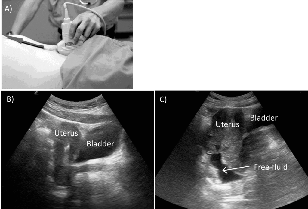 Ultrasound Focused Assessment With Sonography For Trauma FAST Exam  - Trauma Flow Chart Fast Exam